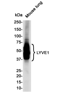 Rabbit Monoclonal Antibody to LYVE1