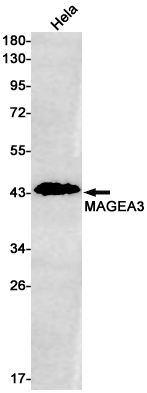Rabbit Monoclonal Antibody to MAGEA3