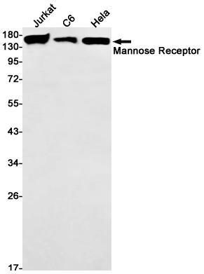 Rabbit Monoclonal Antibody to Mannose Receptor