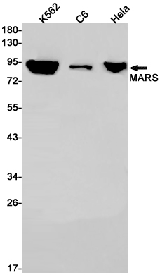 Rabbit Monoclonal Antibody to MetRS