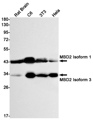 Rabbit Monoclonal Antibody to MBD2