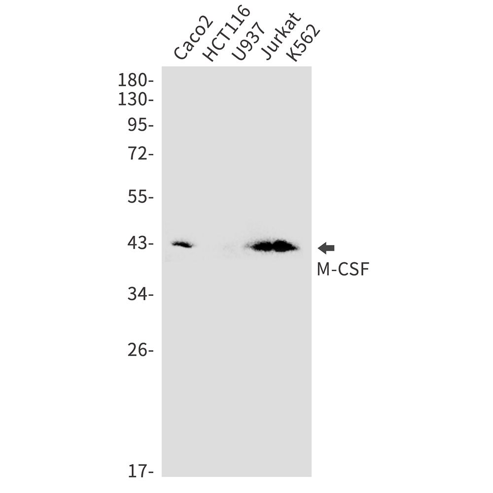 Rabbit Monoclonal Antibody to M-CSF
