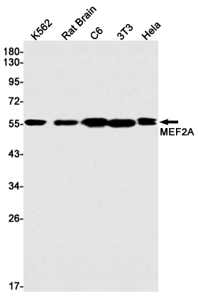 Rabbit Monoclonal Antibody to MEF2A