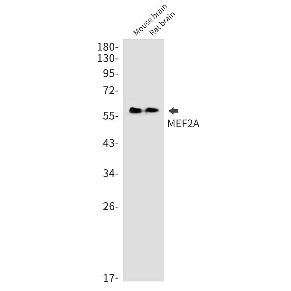 Rabbit Monoclonal Antibody to MEF2A