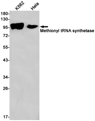 Rabbit Monoclonal Antibody to MetRS