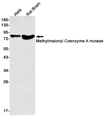 Rabbit Monoclonal Antibody to Methylmalonyl Coenzyme A mutase