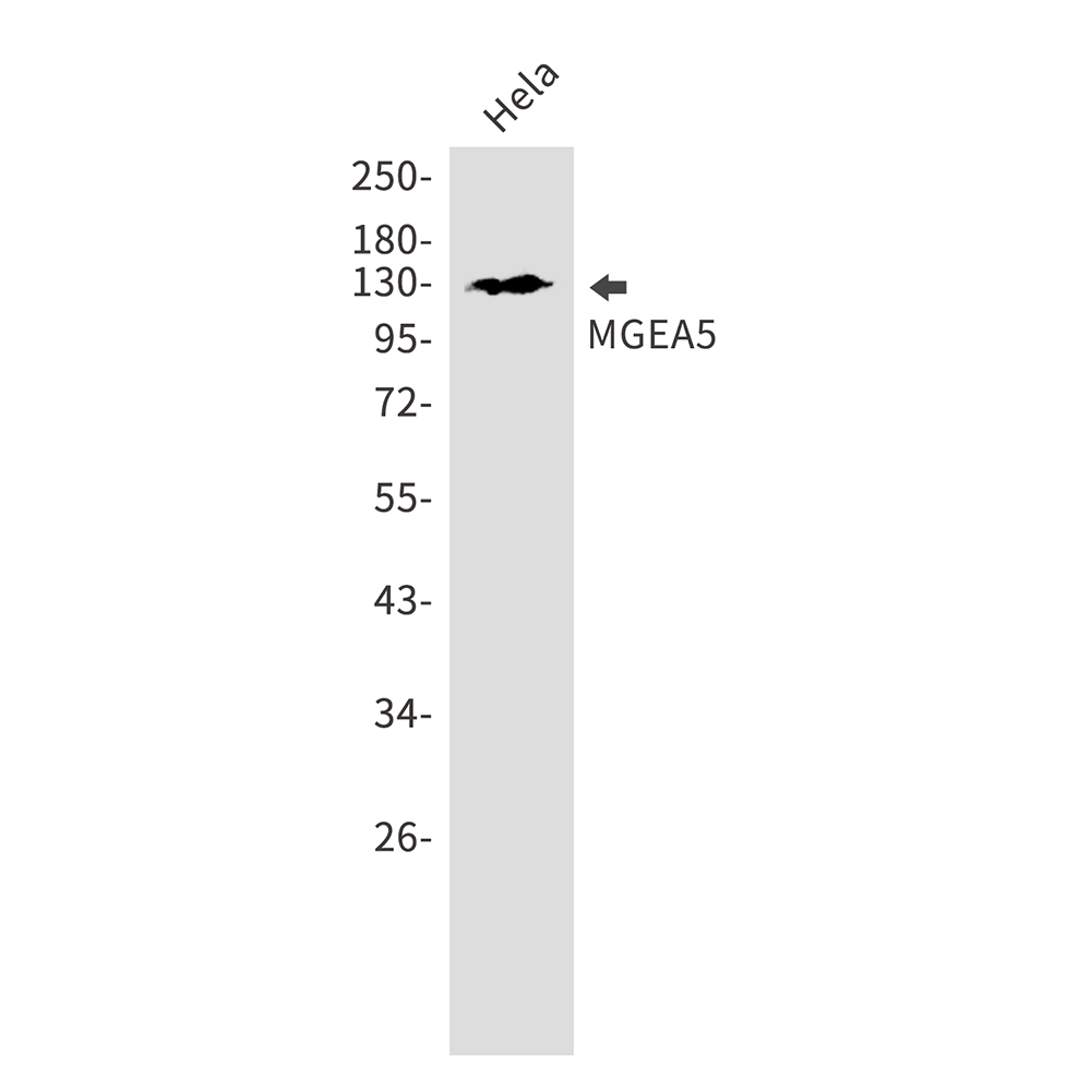 Rabbit Monoclonal Antibody to OGA