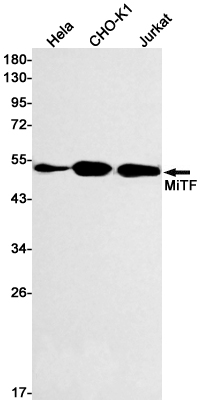 Rabbit Monoclonal Antibody to MiTF