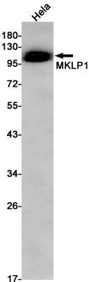 Rabbit Monoclonal Antibody to MKLP1