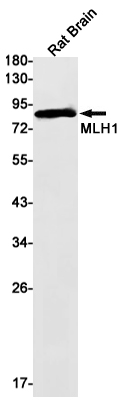 Rabbit Monoclonal Antibody to MLH1