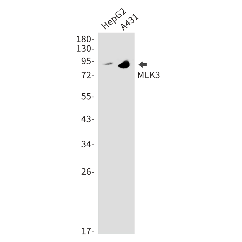 Rabbit Monoclonal Antibody to MLK3