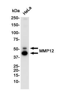 Rabbit Monoclonal Antibody to MMP12