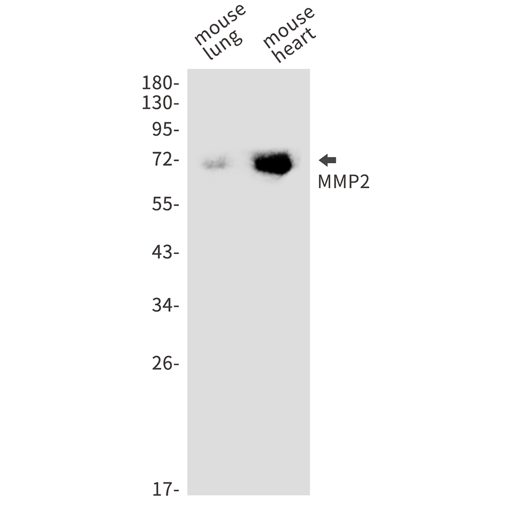 Rabbit Monoclonal Antibody to MMP2