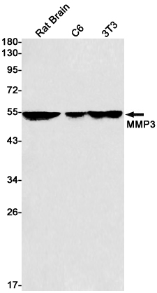 Rabbit Monoclonal Antibody to MMP3
