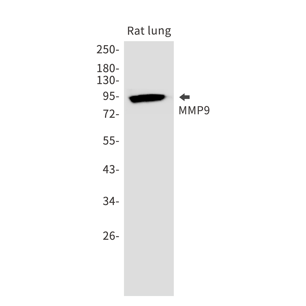 Rabbit Monoclonal Antibody to MMP9
