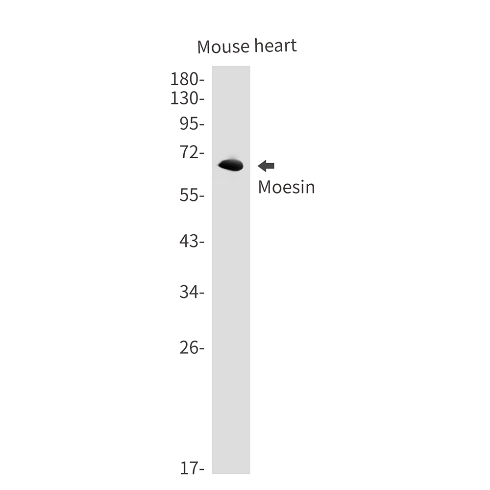 Rabbit Monoclonal Antibody to Moesin