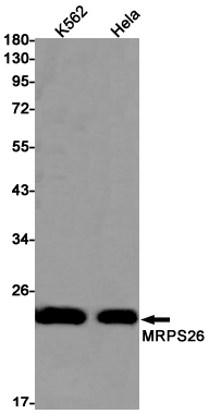 Rabbit Monoclonal Antibody to MRPS26