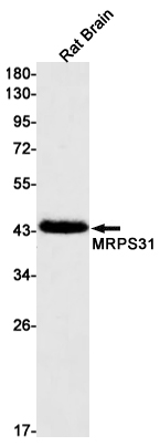 Rabbit Monoclonal Antibody to MRPS31