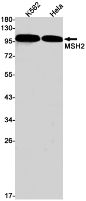 Rabbit Monoclonal Antibody to MSH2