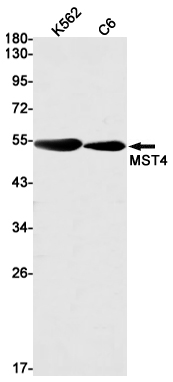 Rabbit Monoclonal Antibody to MST4