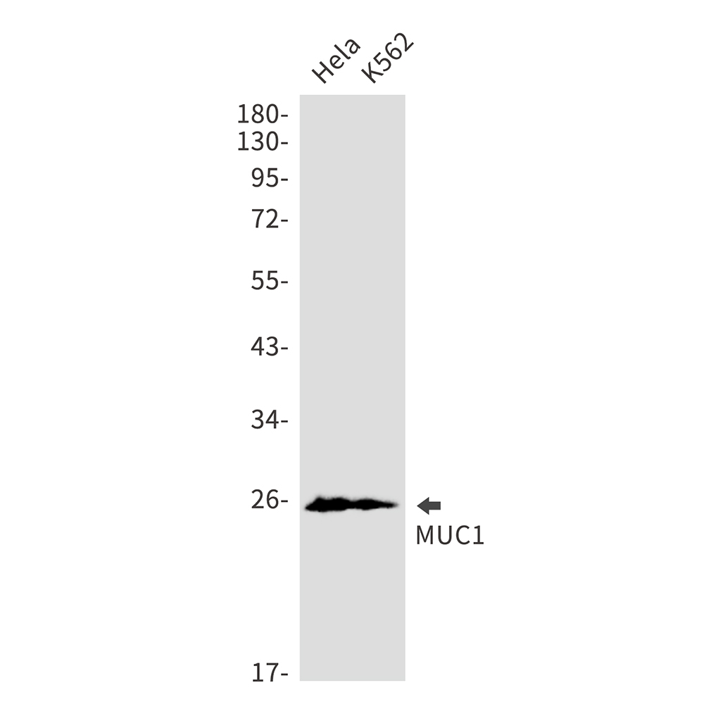 Rabbit Monoclonal Antibody to Mucin 1