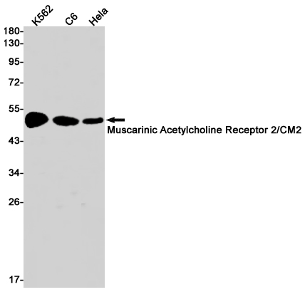 Rabbit Monoclonal Antibody to Muscarinic Acetylcholine Receptor M2