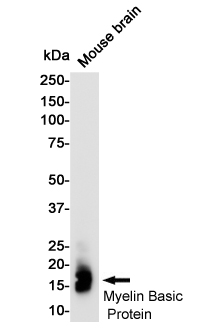 Rabbit Monoclonal Antibody to Myelin Basic Protein