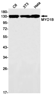 Rabbit Monoclonal Antibody to MYO1B