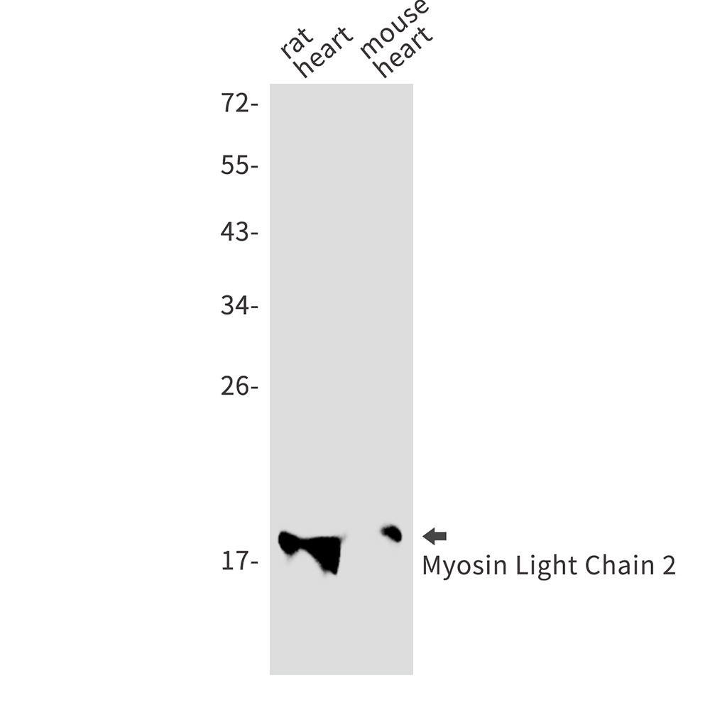 Rabbit Monoclonal Antibody to MYL2
