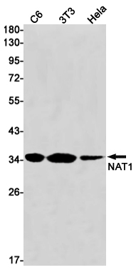 Rabbit Monoclonal Antibody to NAT1