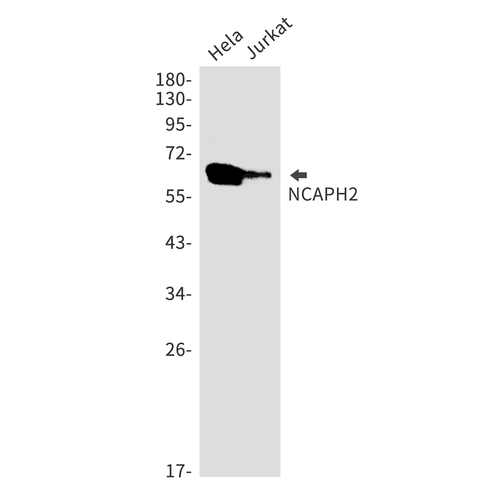Rabbit Monoclonal Antibody to NCAPH2