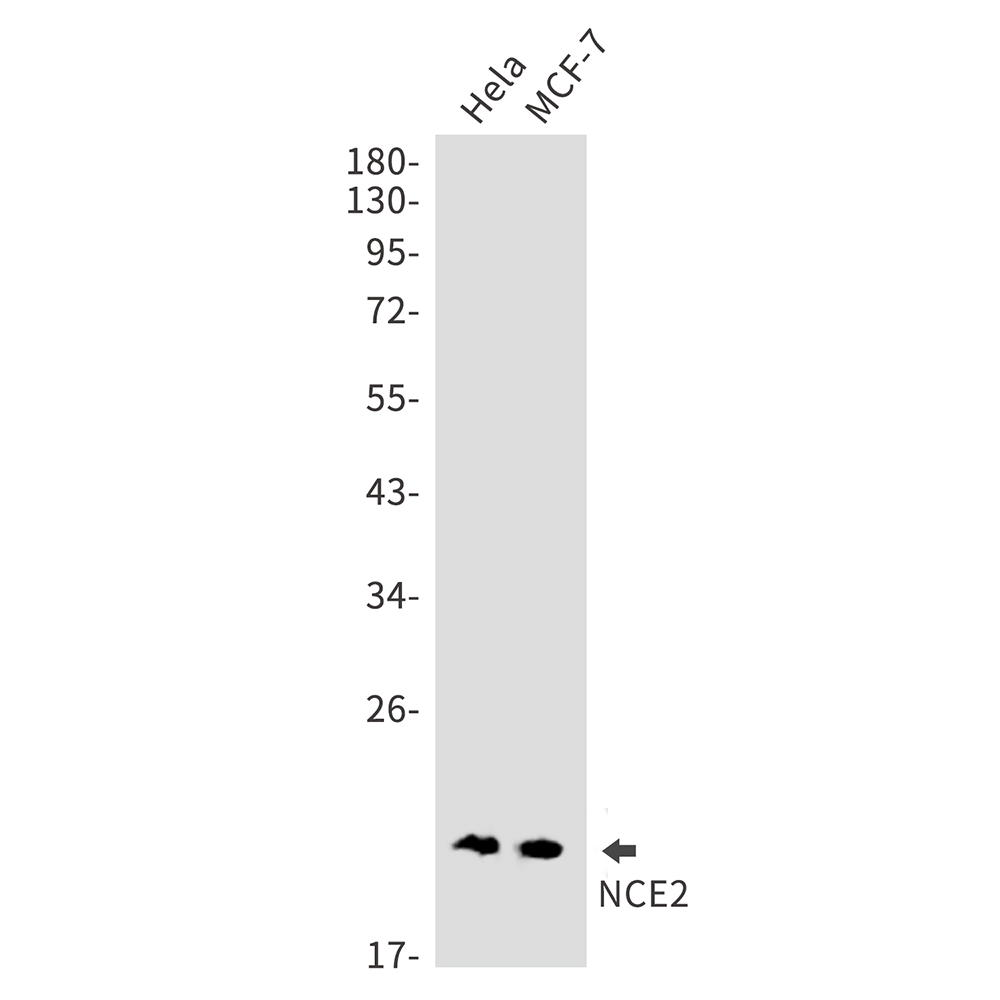 Rabbit Monoclonal Antibody to NCE2