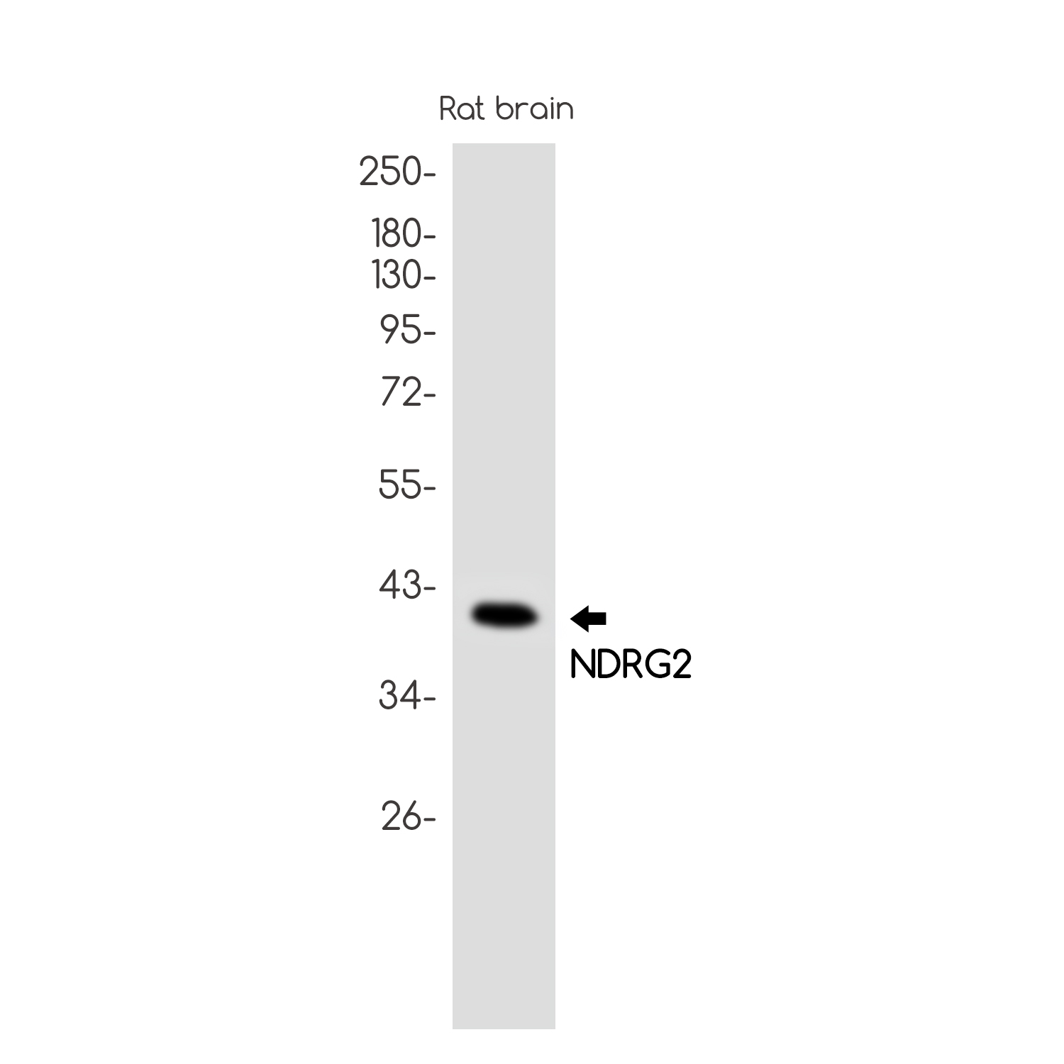 Rabbit Monoclonal Antibody to NDRG2