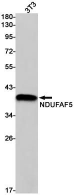 Rabbit Monoclonal Antibody to NDUFAF5