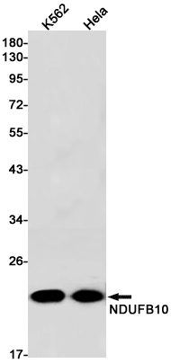Rabbit Monoclonal Antibody to NDUFB10