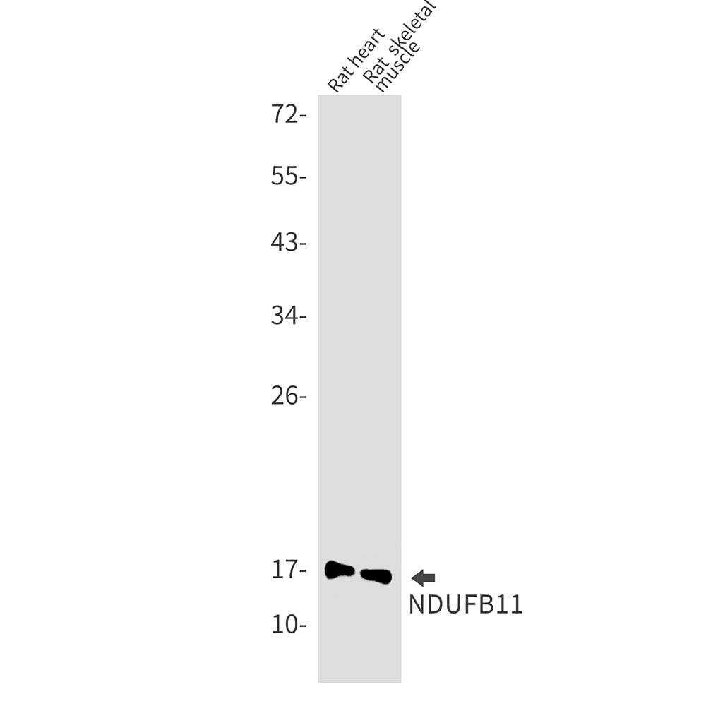 Rabbit Monoclonal Antibody to NDUFB11
