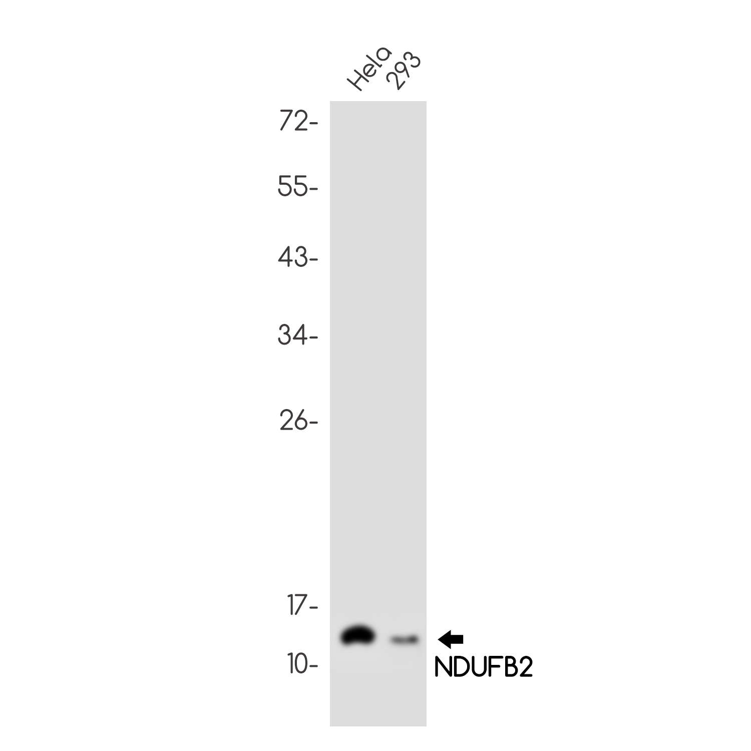 Rabbit Monoclonal Antibody to NDUFB2