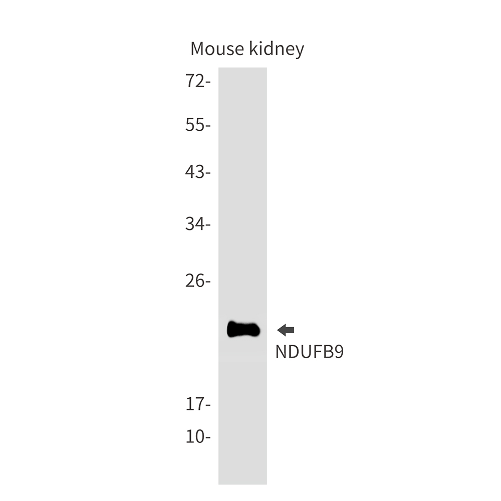 Rabbit Monoclonal Antibody to NDUFB9