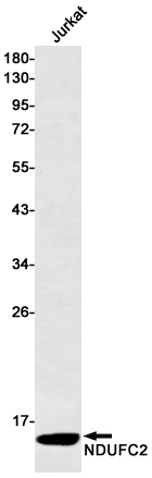 Rabbit Monoclonal Antibody to NDUFC2