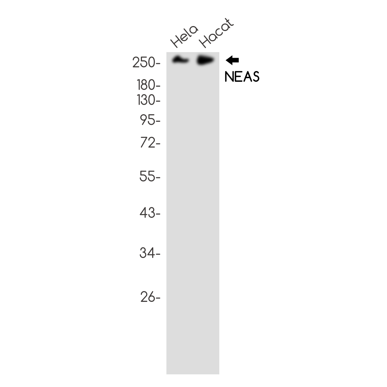Rabbit Monoclonal Antibody to NEAS
