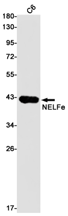 Rabbit Monoclonal Antibody to NELFE