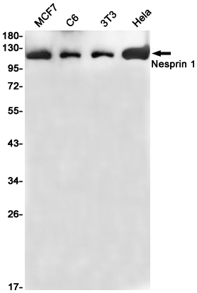 Rabbit Monoclonal Antibody to Nesprin1