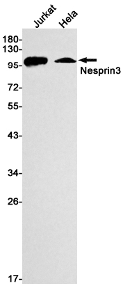 Rabbit Monoclonal Antibody to Nesprin3
