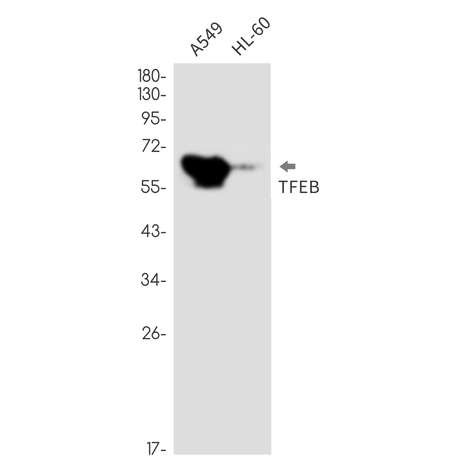 Rabbit Monoclonal Antibody to Transcription Factor EB