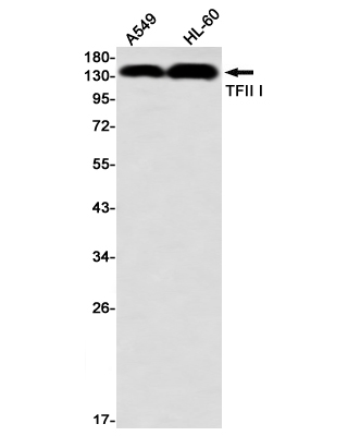 Rabbit Monoclonal Antibody to General Transcription Factor II I