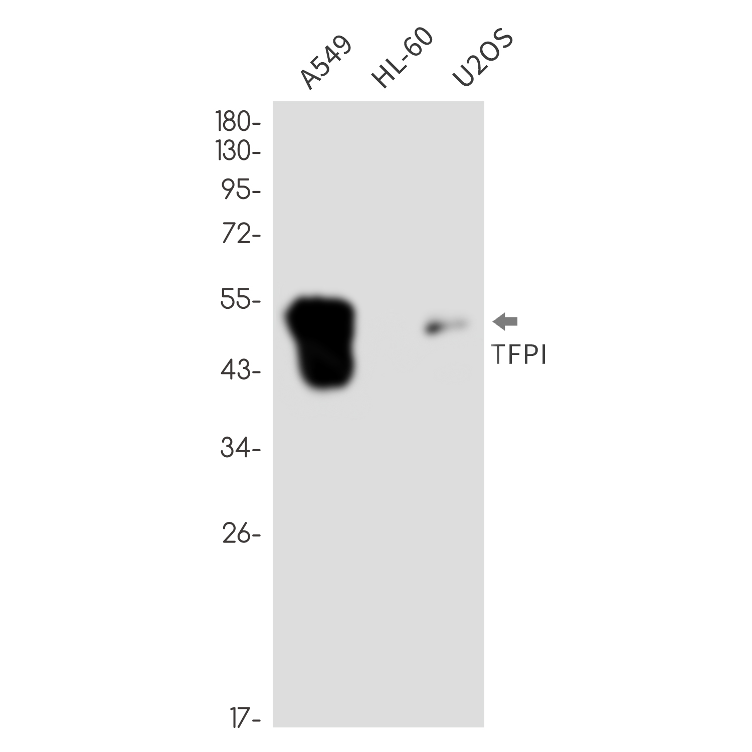 Rabbit Monoclonal Antibody to Tissue Factor Pathway Inhibitor
