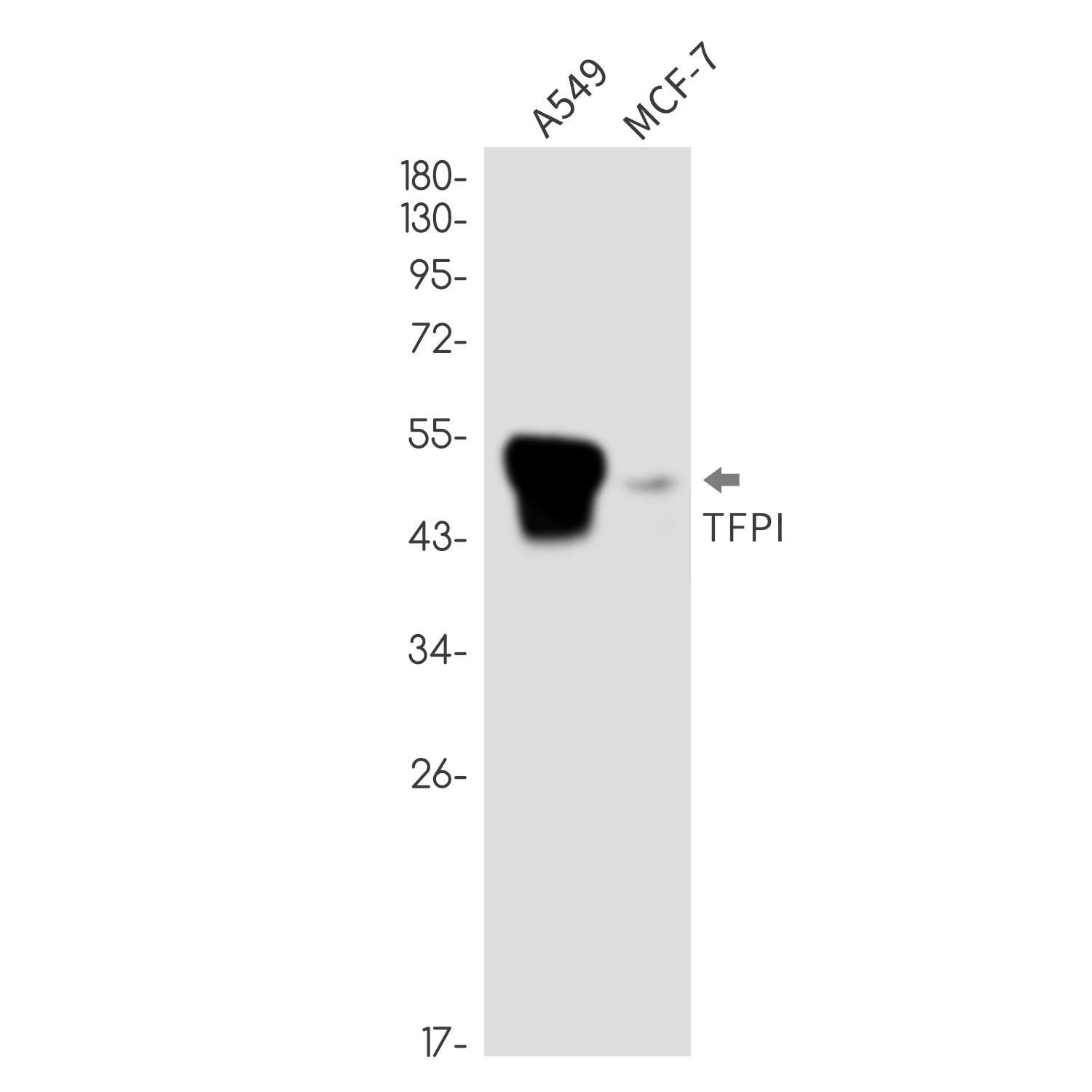 Rabbit Monoclonal Antibody to Tissue Factor Pathway Inhibitor