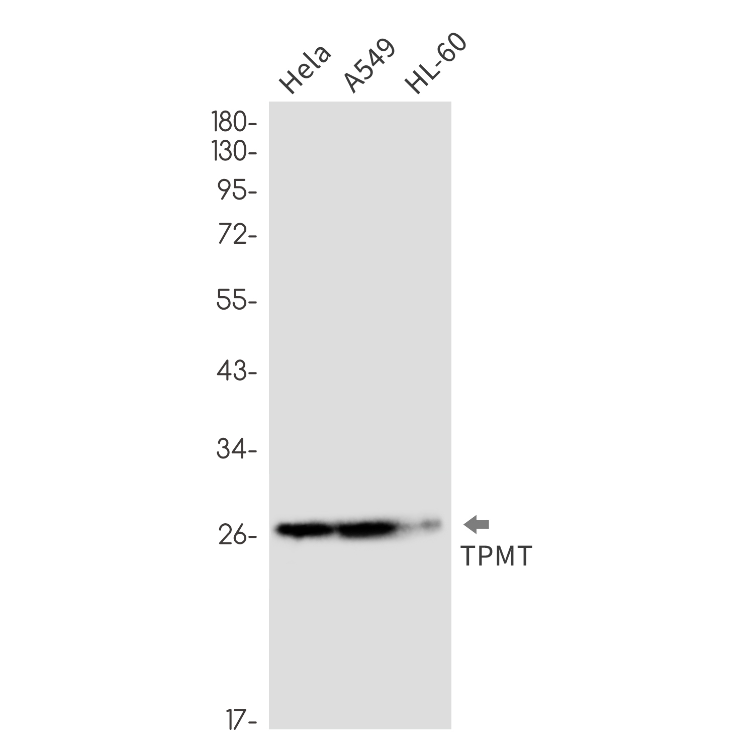 Rabbit Monoclonal Antibody to TPMT