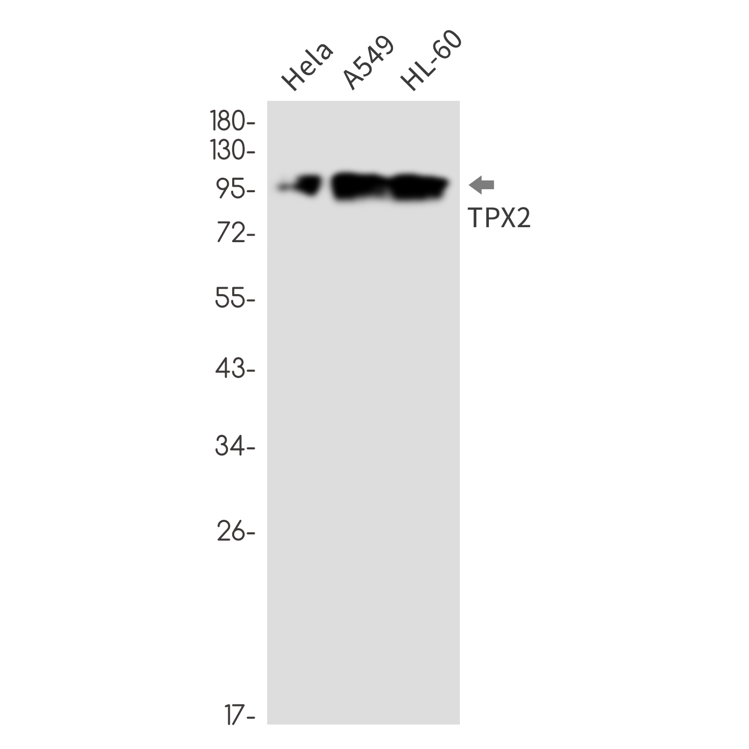 Rabbit Monoclonal Antibody to TPX2