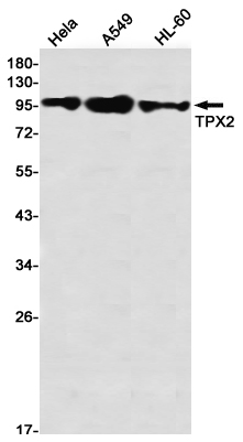 Rabbit Monoclonal Antibody to TPX2
